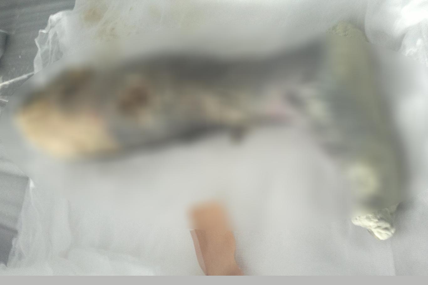 Sigara bir hayatı daha kararttı Sigara bir hayatı daha kararttı